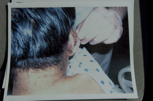 Ears of housekeepers cut as torture